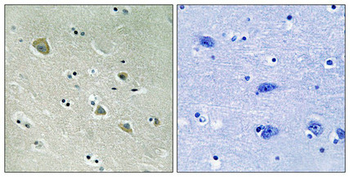PAK1 Antibody