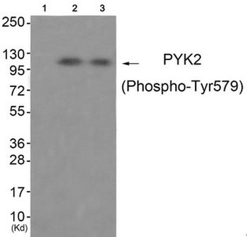 PTK2B Antibody