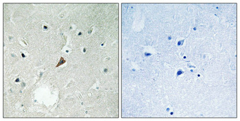 PTK2B Antibody