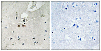EFNB1/EFNB2/EFNB3 Antibody