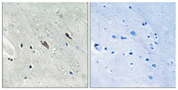 GAB2 Antibody