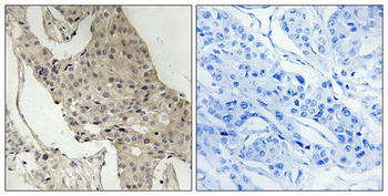 GAB2 Antibody