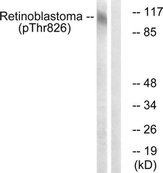 RB1 Antibody