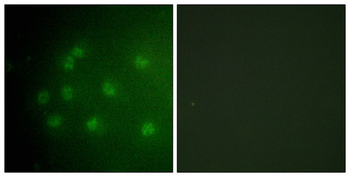 RB1 Antibody
