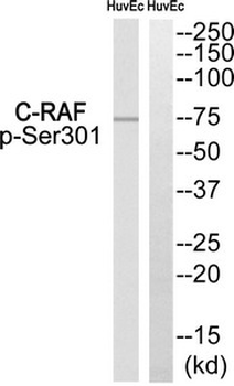 RAF1 Antibody