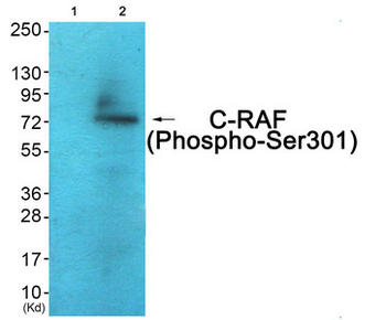 RAF1 Antibody