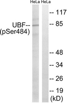 UBTF Antibody