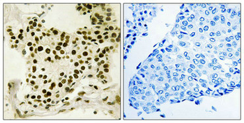 UBTF Antibody
