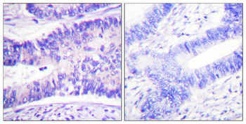 WASF1 Antibody