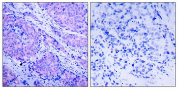 PDPK1 Antibody