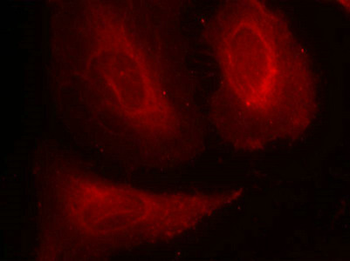 PDPK1 Antibody