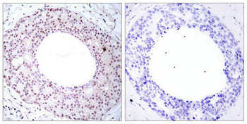 RELA Antibody