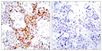 ATF2 Antibody