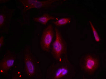 ATF2 Antibody