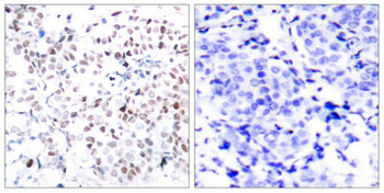 MYC Antibody