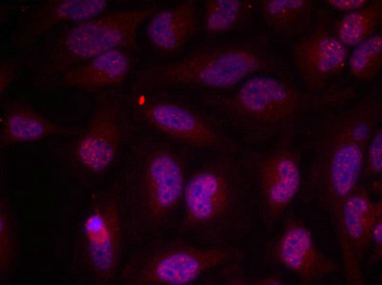 MYC Antibody