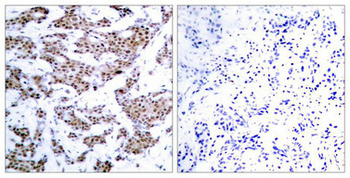 MEF2A Antibody