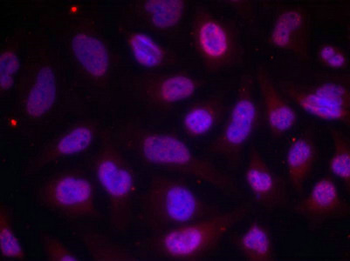 MEF2A Antibody