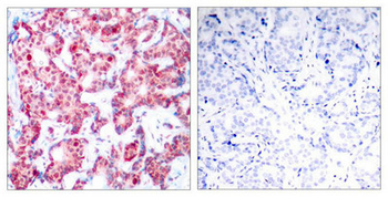 GATA1 Antibody