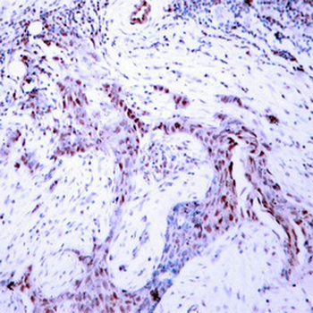 PGR Antibody
