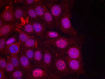 PGR Antibody