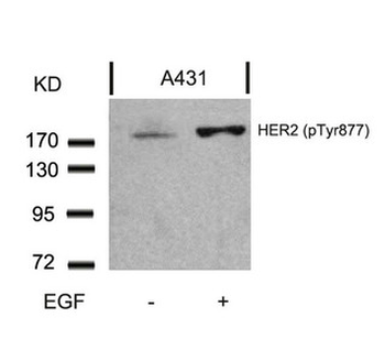 ERBB2 Antibody