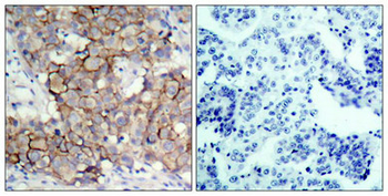 ERBB2 Antibody