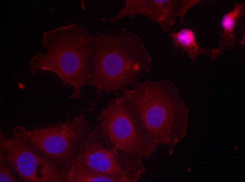 ERBB2 Antibody