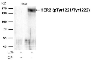 ERBB2 Antibody