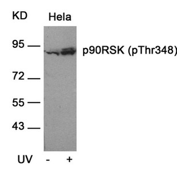 RPS6KA1 Antibody