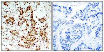 RPS6KA1 Antibody