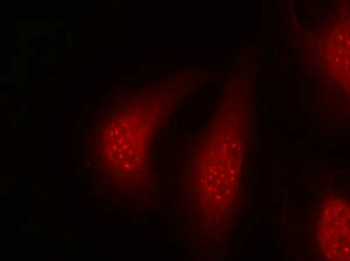 RPS6KA1 Antibody