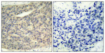 LIMK1 Antibody