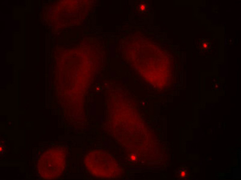 LIMK1 Antibody