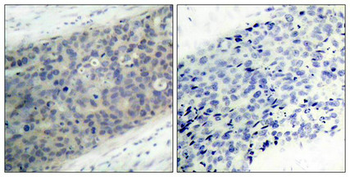 LIMK2 Antibody