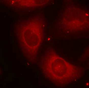 LIMK2 Antibody