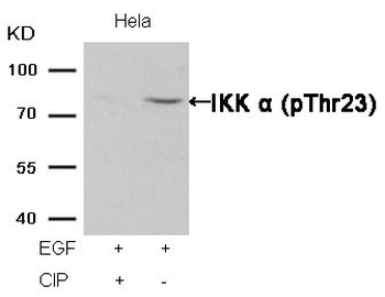 CHUK Antibody