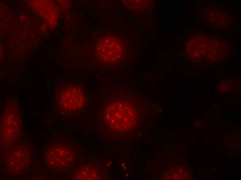 FOXO4 Antibody