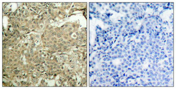 CFL1 Antibody