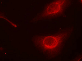 CFL1 Antibody