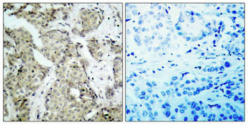 MAP2K6 Antibody