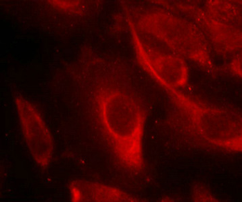 MAP2K6 Antibody