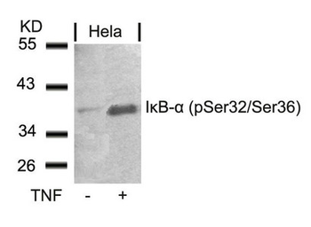 NFKBIA Antibody