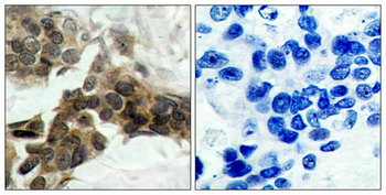 NFKBIA Antibody