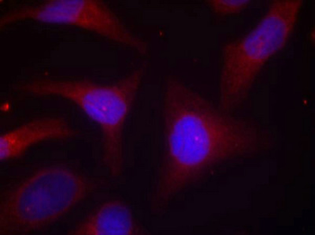 NFKBIA Antibody
