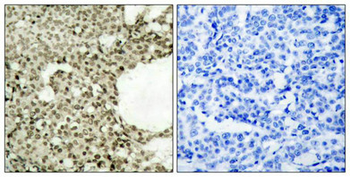 STAT1 Antibody