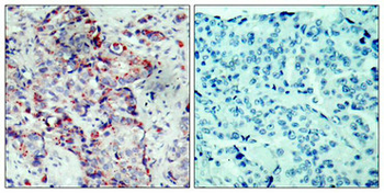 MAP2K4 Antibody