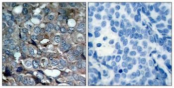 MAP3K5 Antibody