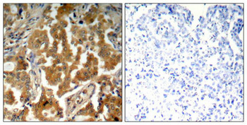 ADD1 Antibody