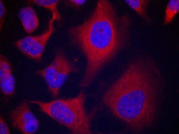 ADD1 Antibody